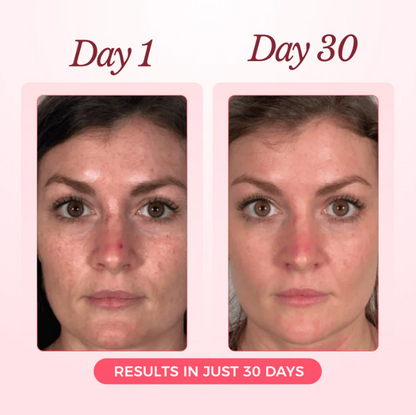 MYGLIDE Nightmask Gel™